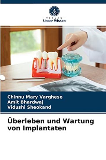 Überleben und Wartung von Implantaten – Chinnu Mary Varghese, kirjan kansikuva