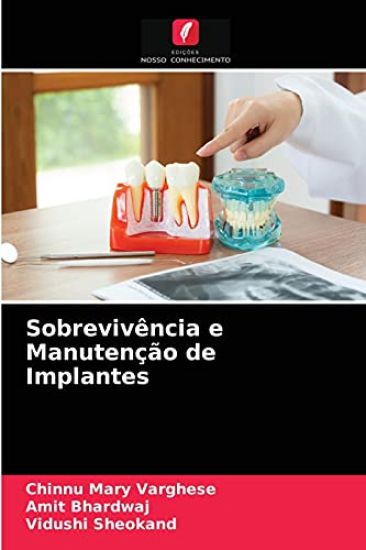 Sobrevivência e Manutenção de Implantes – Chinnu Mary Varghese, kirjan kansikuva