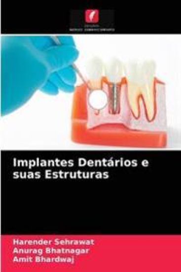Implantes Dentários e suas Estruturas