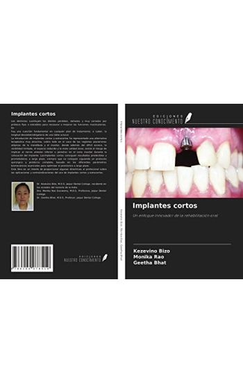Implantes cortos