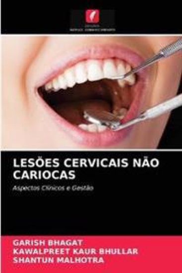 Lesões Cervicais Não Cariocas