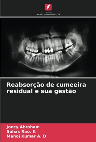 Reabsorção de cumeeira residual e sua gestão