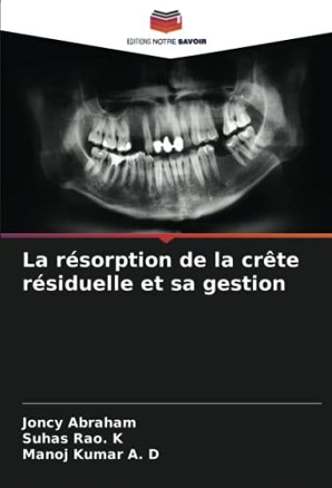 La résorption de la crête résiduelle et sa gestion