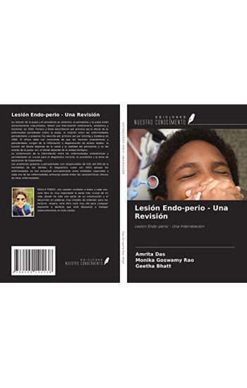 Lesión Endo-perio - Una Revisión