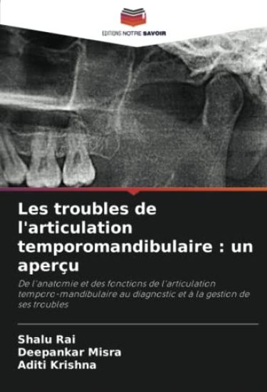 Les troubles de l'articulation temporomandibulaire : un aperçu