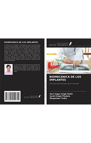 BIOMECÁNICA DE LOS IMPLANTES