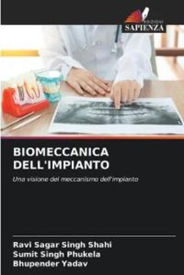 Biomeccanica Dell'impianto