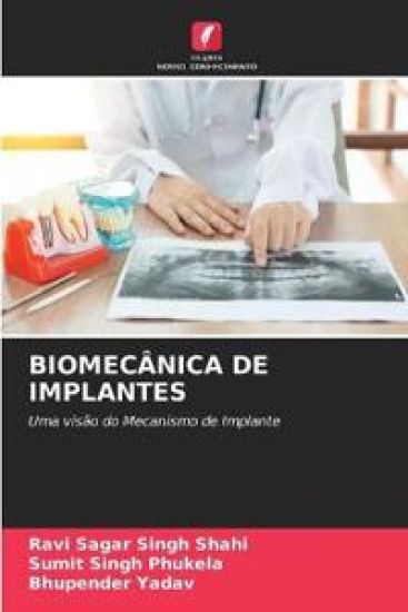 Biomecânica de Implantes