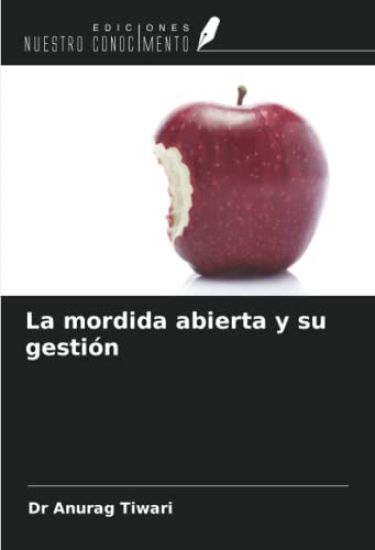 La mordida abierta y su gestión
