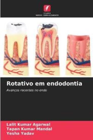 Rotativo em endodontia