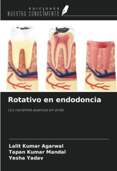 Rotativo en endodoncia