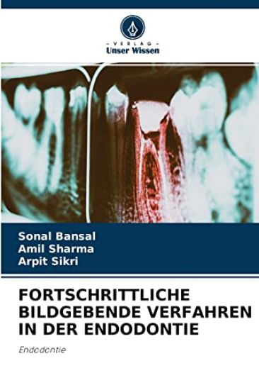 Fortschrittliche Bildgebende Verfahren in Der Endodontie – Sonal Bansal, kirjan kansikuva