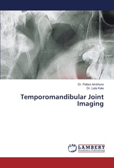 Temporomandibular Joint Imaging
