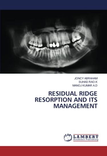 RESIDUAL RIDGE RESORPTION AND ITS MANAGEMENT