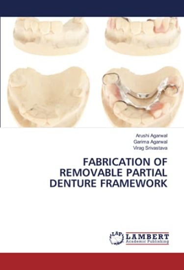 FABRICATION OF REMOVABLE PARTIAL DENTURE FRAMEWORK