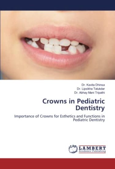 Crowns in Pediatric Dentistry