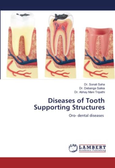 Diseases of Tooth Supporting Structures