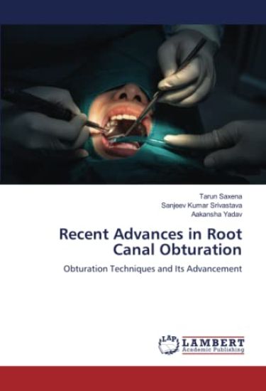Recent Advances in Root Canal Obturation