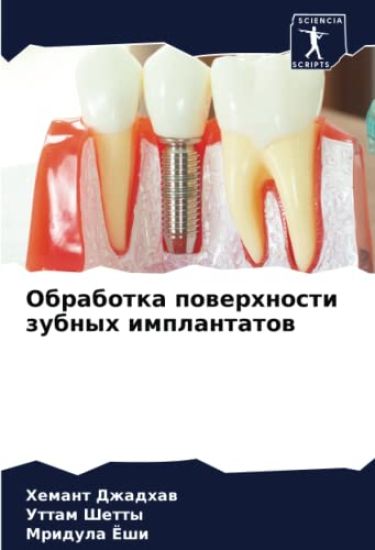 Obrabotka powerhnosti zubnyh implantatow