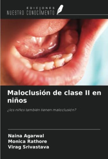 Maloclusión de clase II en niños
