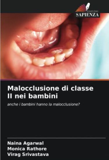 Malocclusione di classe II nei bambini