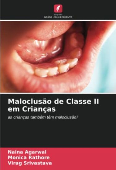 Maloclusão de Classe II em Crianças