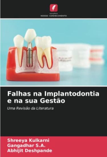 Falhas na Implantodontia e na sua Gestão
