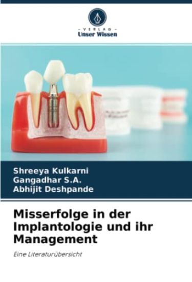 Misserfolge in der Implantologie und ihr Management