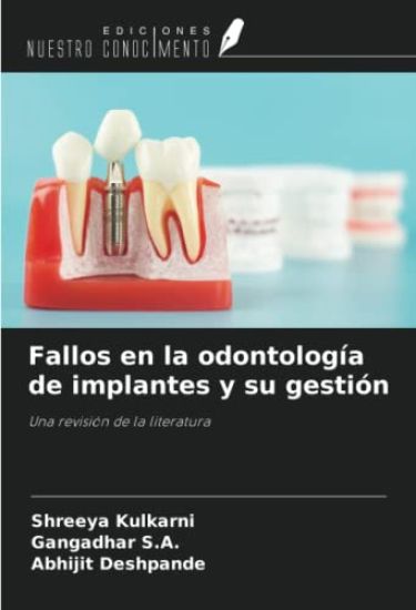 Fallos en la odontología de implantes y su gestión