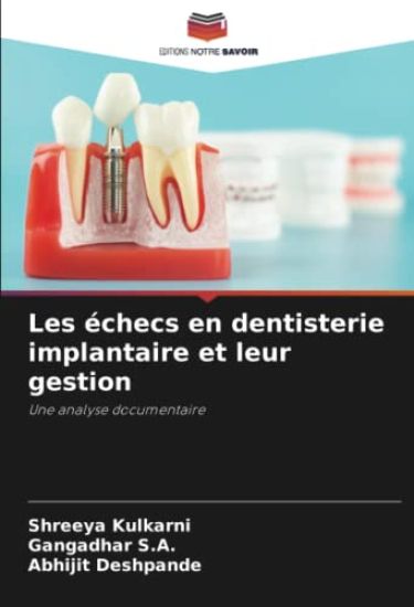 Les échecs en dentisterie implantaire et leur gestion