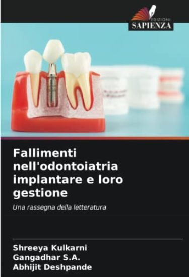 Fallimenti nell'odontoiatria implantare e loro gestione
