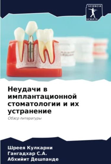 Neudachi w implantacionnoj stomatologii i ih ustranenie