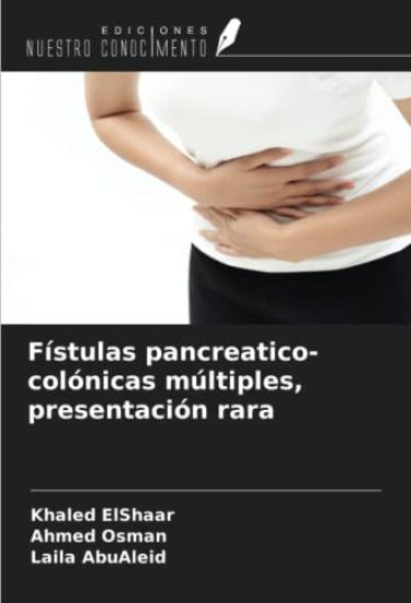 Fístulas pancreatico-colónicas múltiples, presentación rara