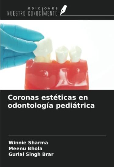 Coronas estéticas en odontología pediátrica