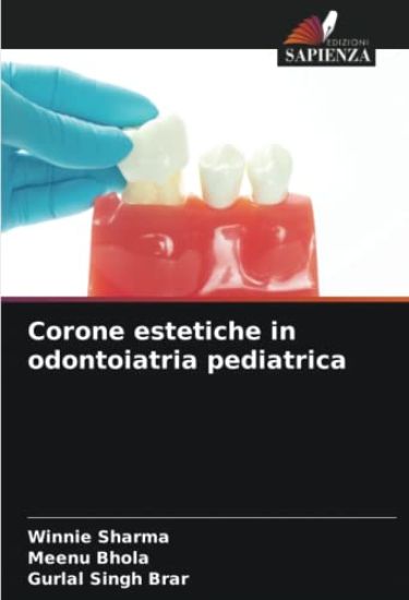 Corone estetiche in odontoiatria pediatrica