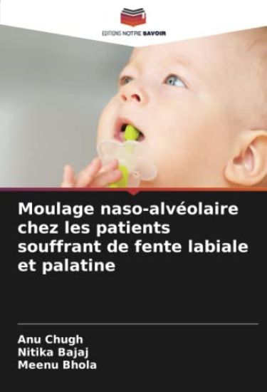 Moulage naso-alvéolaire chez les patients souffrant de fente labiale et palatine