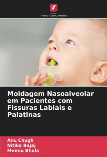 Moldagem Nasoalveolar em Pacientes com Fissuras Labiais e Palatinas