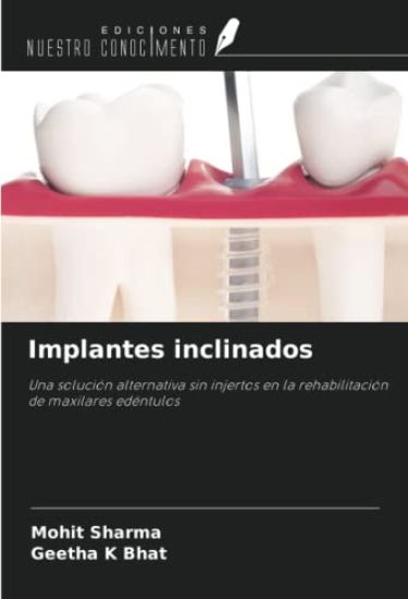 Implantes inclinados