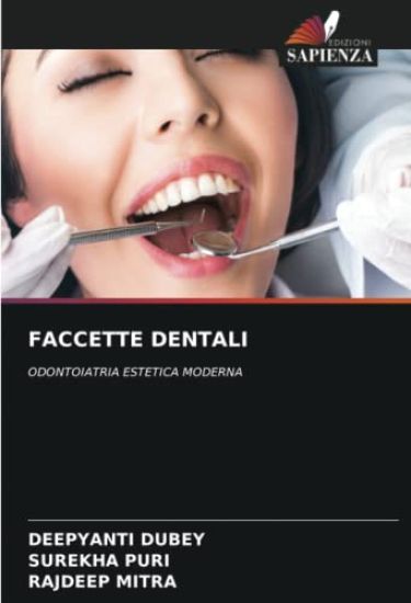 FACCETTE DENTALI