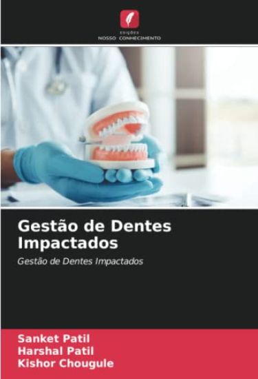 Gestão de Dentes Impactados