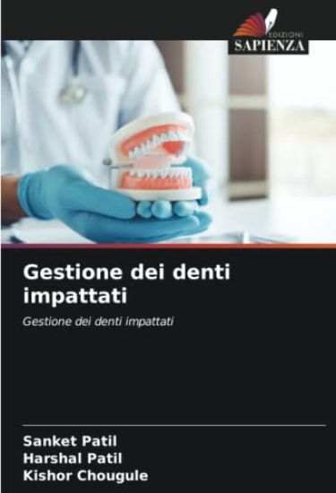 Gestione dei denti impattati