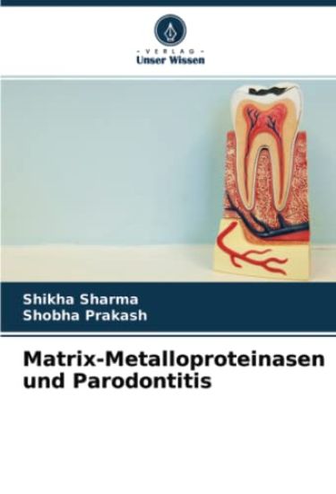 Matrix-Metalloproteinasen und Parodontitis