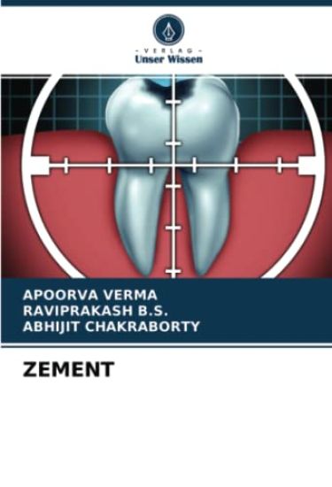 ZEMENT