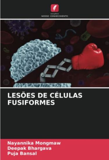 LESÕES DE CÉLULAS FUSIFORMES