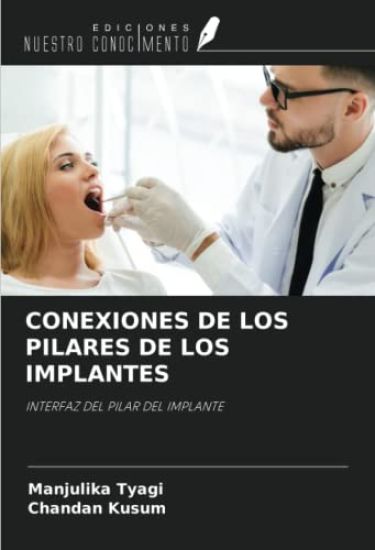 CONEXIONES DE LOS PILARES DE LOS IMPLANTES