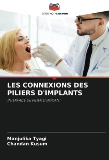 LES CONNEXIONS DES PILIERS D'IMPLANTS
