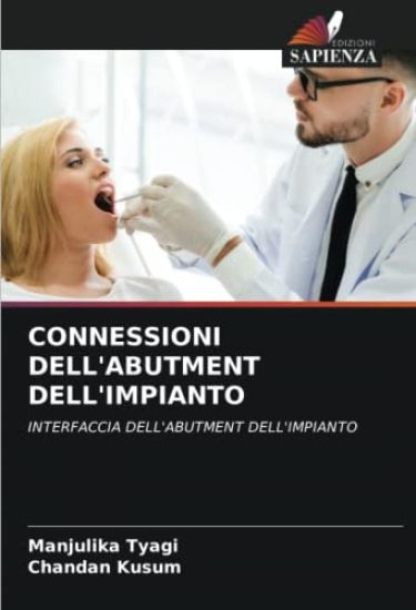 CONNESSIONI DELL'ABUTMENT DELL'IMPIANTO