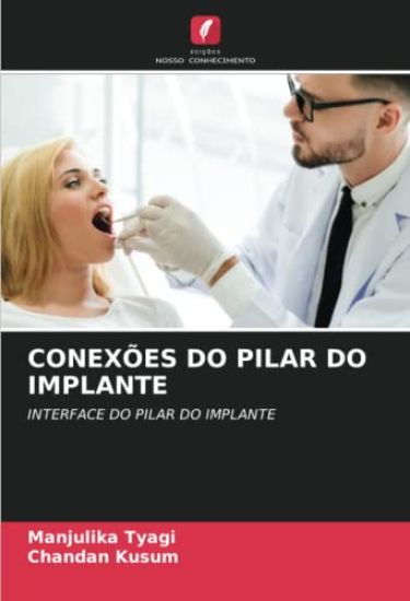 CONEXÕES DO PILAR DO IMPLANTE