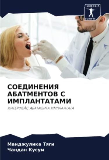SOEDINENIYa ABATMENTOV S IMPLANTATAMI