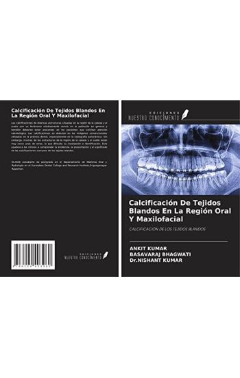 Calcificación De Tejidos Blandos En La Región Oral Y Maxilofacial